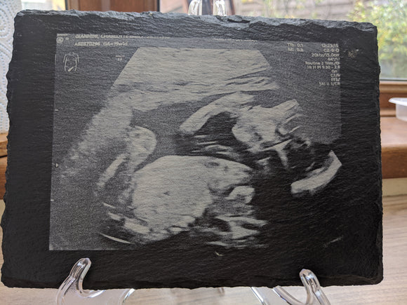 Slate Baby Scan Photo Print